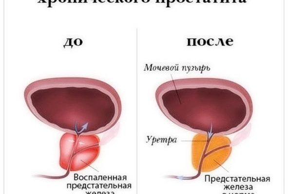 Простамол уно цена в казахстане инструкция по применению