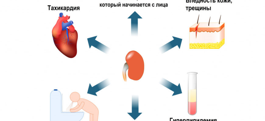 В каких случаях возникает отекшая почка?