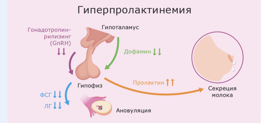 Повышен ли у мужчины пролактин и причины и методы лечения
