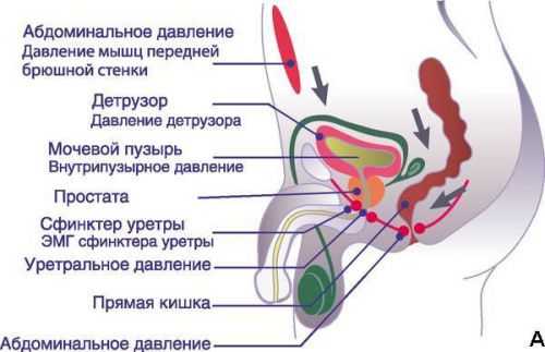 Ургентное недержание мочи