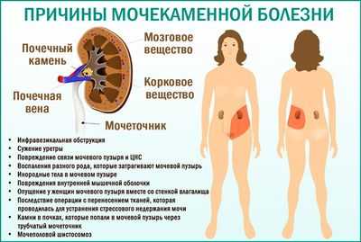 Камень в мочеточнике у мужчин что делать чтобы вышел из мочеточника