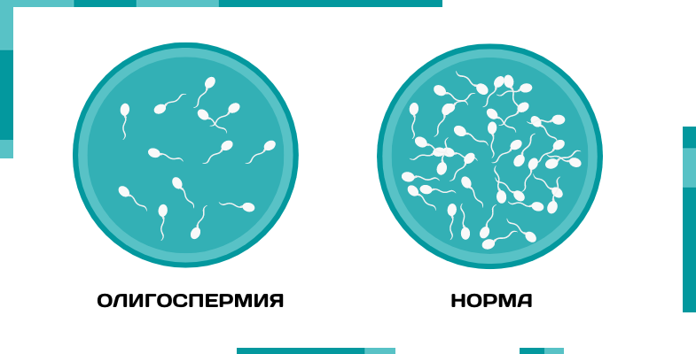 Какая должна быть сперма жидкая или густая