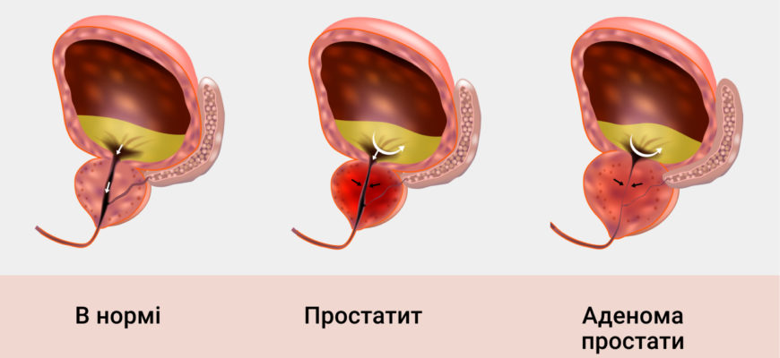 Народные средства от простатита купить в аптеке http kupit doctorprost ru