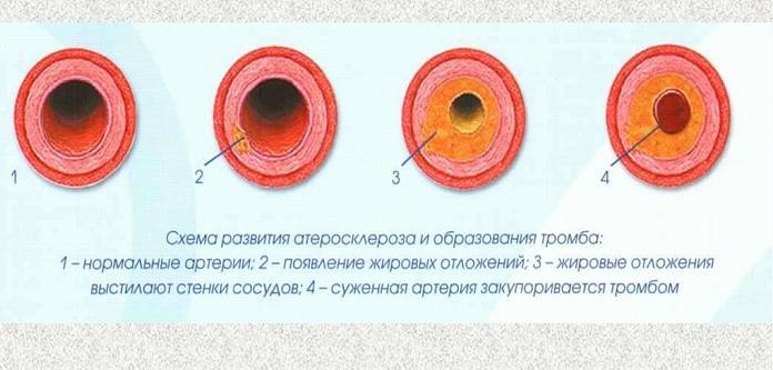 Как улучшить кровообращение в малом тазу у мужчин после 50 лет
